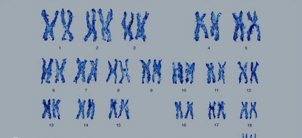 高发人群做染色体筛查能避免染色体异常