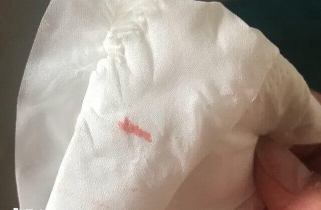 阴道少量出血是着床成功征兆之一