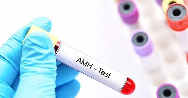 AMH的正常值在2-6.8ng/ml之间