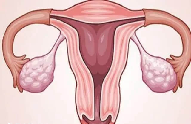 疤痕子宫做试管婴儿