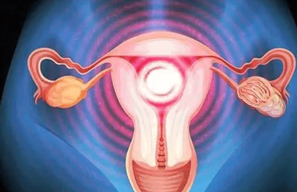 子宫内膜薄调理厚移植也还是需要注意护理