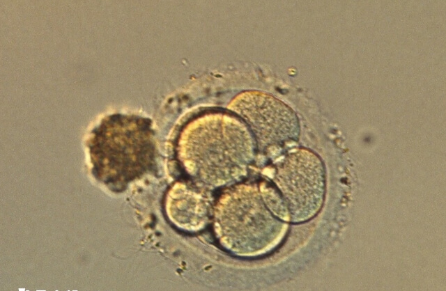 囊胚移植有一定的适应人群范围