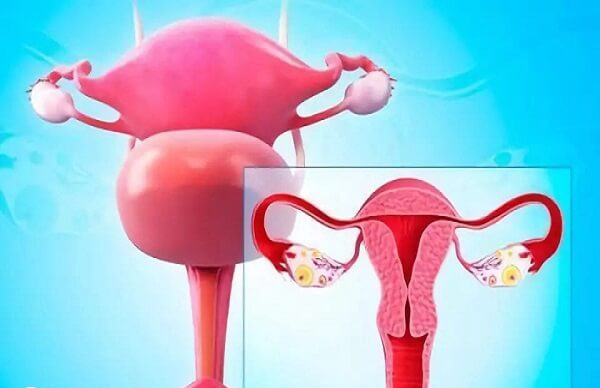 子宫内膜异位症包括先天和后天