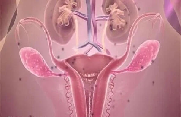 宫腔残留物易出血和感染