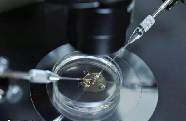 先天性肾积水能做试管婴儿