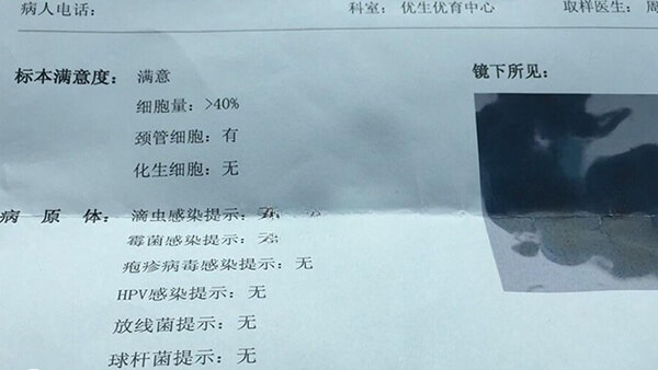 私立医院做hpv和tct检查不如公立医院好