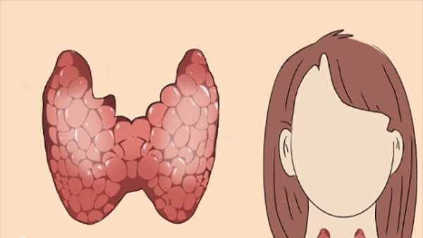 甲亢做试管婴儿的注意事项
