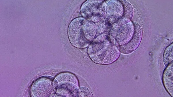 囊胚移植失败后要重视护理恢复健康