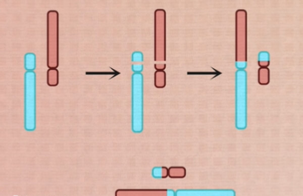 罗氏易位是一种较为复杂的染色体异常
