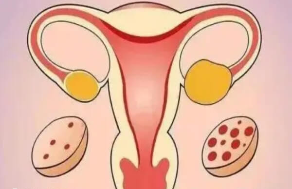 多囊患者可以根据医生建议选促排方案