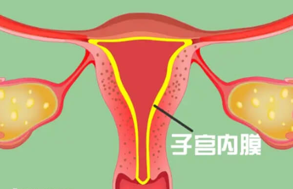 子宫内膜过厚受精卵难以着床