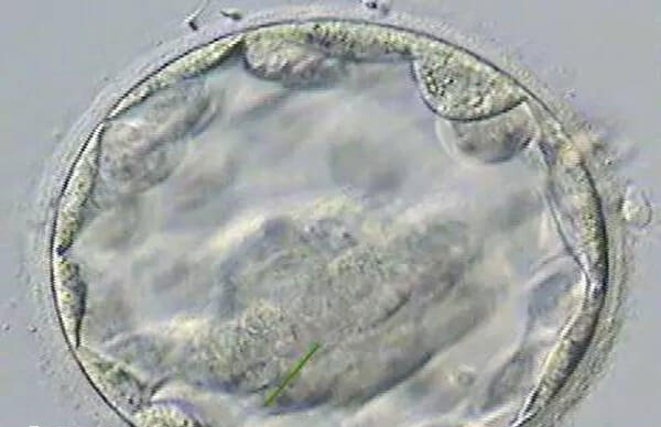 囊胚3cc和5bb的移植成功率不调