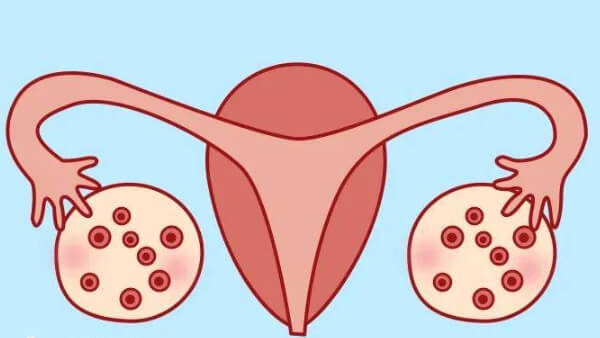 平滑的子宫内膜才是健康的