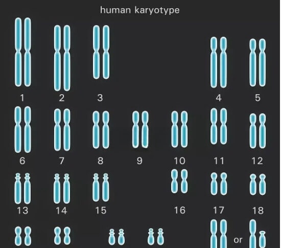 常规检查是诊断13号染色体三体的方法之一