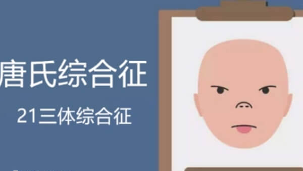 唐氏儿容易患上各种感染性疾病