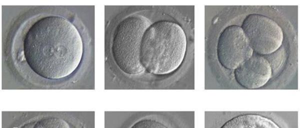 高龄做试管培养囊胚能降低流产风险