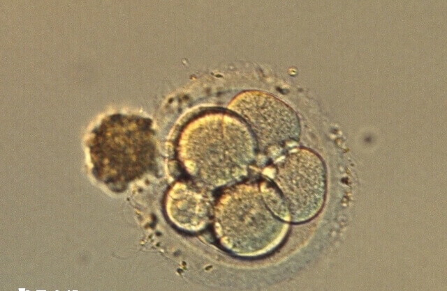 囊胚移植胚胎发育缓慢会影响妊娠稳定