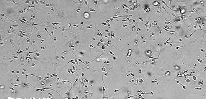弱精症可以做试管婴儿