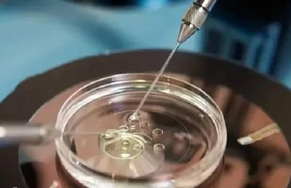 取卵手术操作不当会损耗卵子