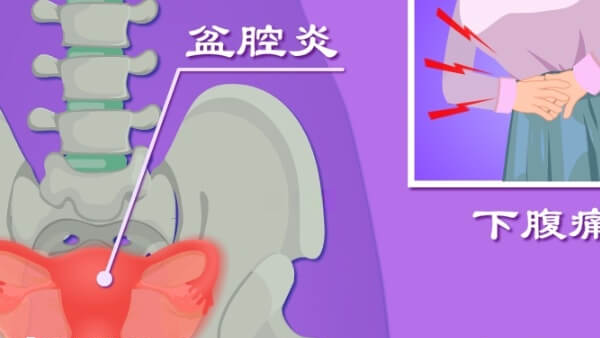 盆腔炎不治疗会干扰三代试管成功率