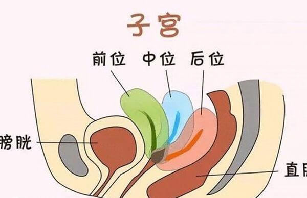 子宫前位是子宫正常位置之一
