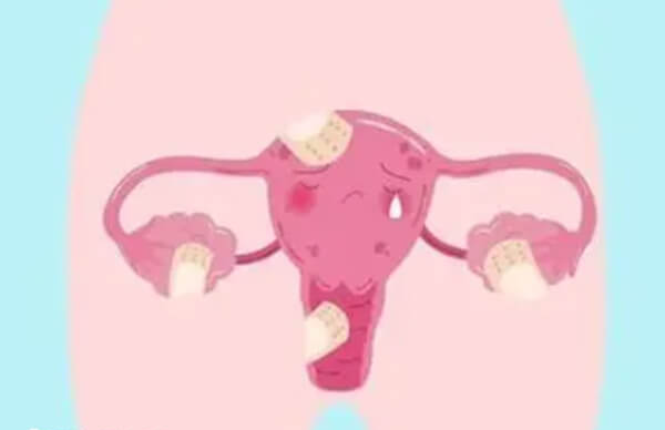不孕症可以提前预防和改善
