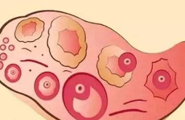 孕前检查卵巢功能很关键