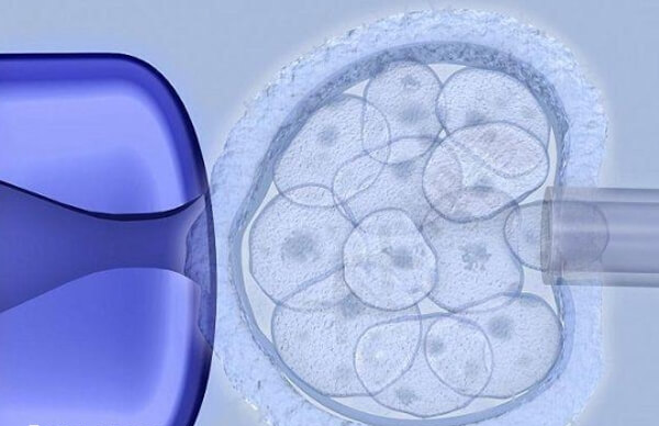卵巢早衰配合医生做试管婴儿能成功
