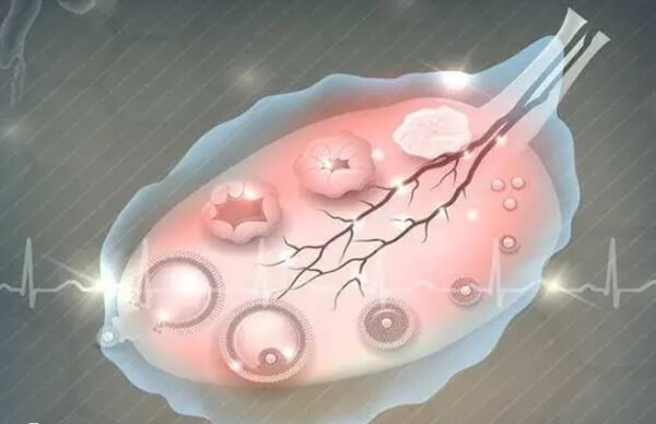 多囊看具体情况是否适合做试管婴儿