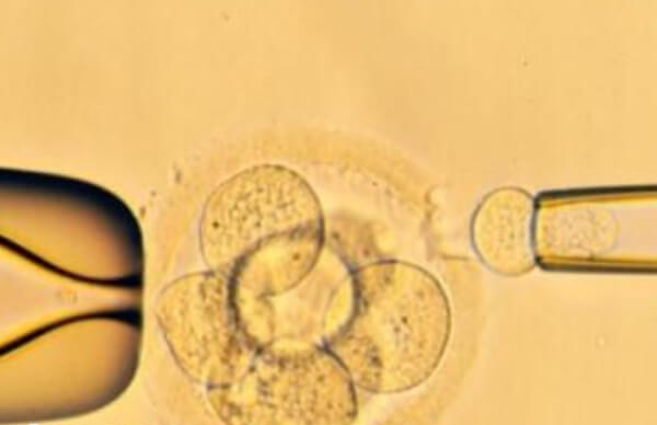 囊胚移植并非一定能成功