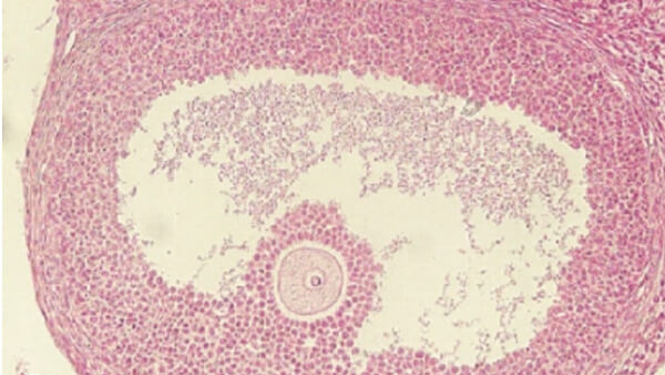 检查窦卵泡有助于评估女性卵巢功能