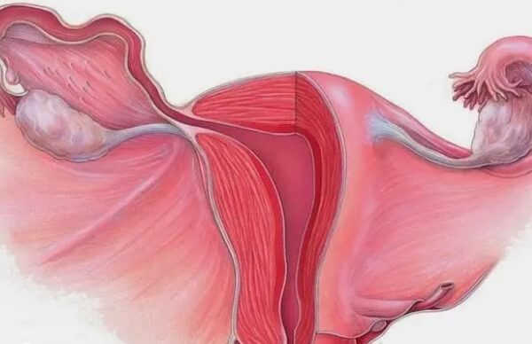 不同子宫畸形在生育上的影响不同