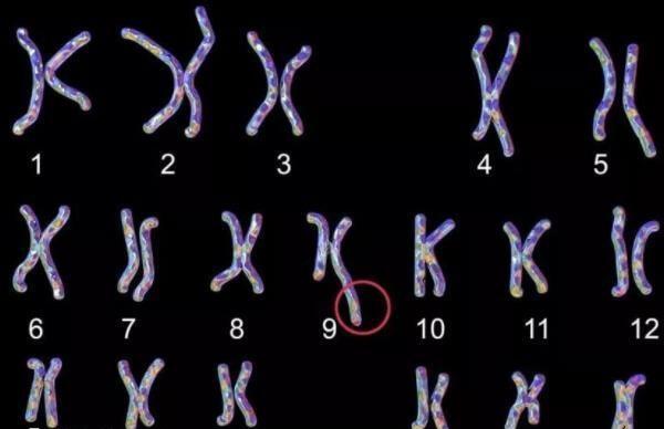 三代试管婴儿能帮助规避克氏综合征