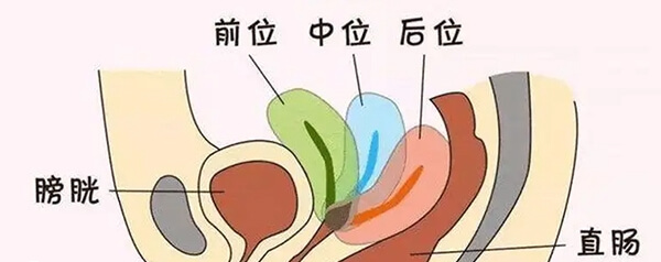 子宫后位移植囊胚后要注意生活和饮食问题