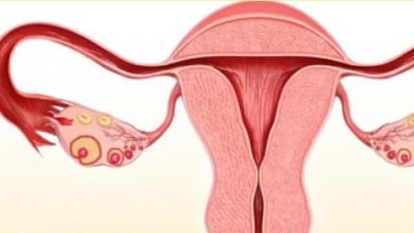 右宫角粘连要先做宫腔镜分离粘连
