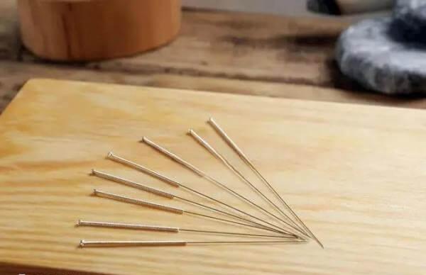 试管婴儿促排期间针灸不宜太频繁