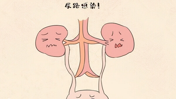 轻微尿路感染可能影响做试管婴儿
