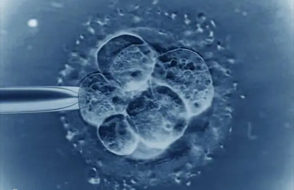 试管婴儿取卵有伤害