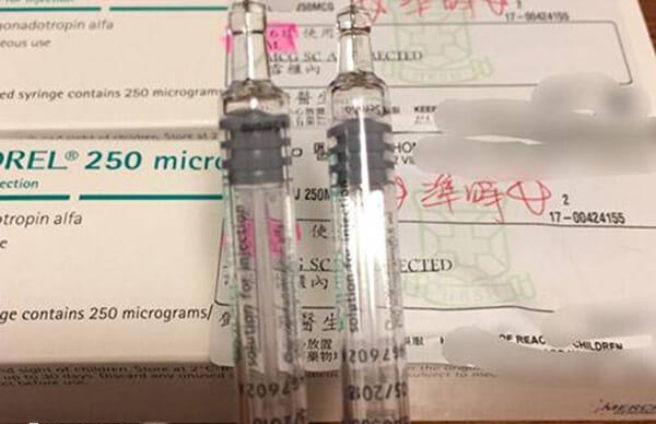 短方案促排可减少卵巢刺激