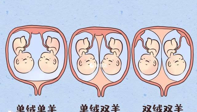单绒和双绒双胞胎示意图