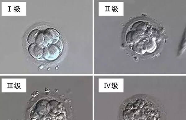 第3天胚胎可以分为四个等级