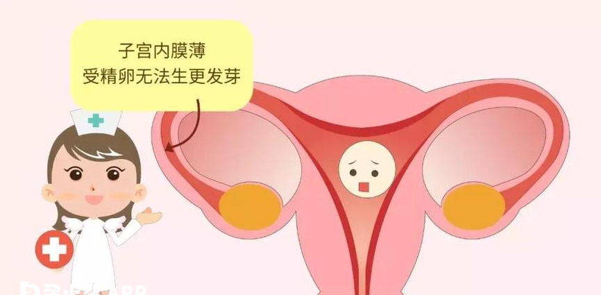 胚胎移植前内膜薄需要先改善