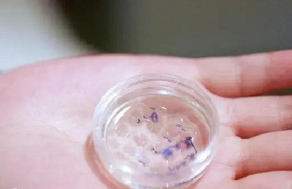 大多数女性在移植后是没有感觉的
