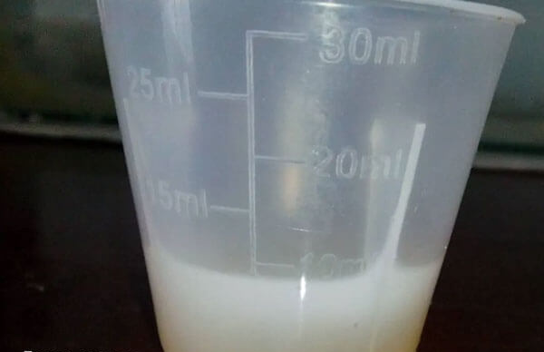 过少的精液量可能提示男性生殖系统存在问题