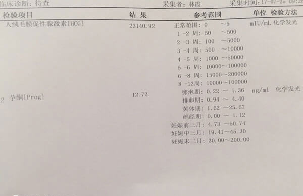 胚胎移植后血hcg值会翻倍增长