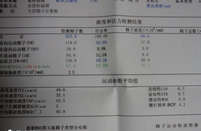 男性不育要检查精子