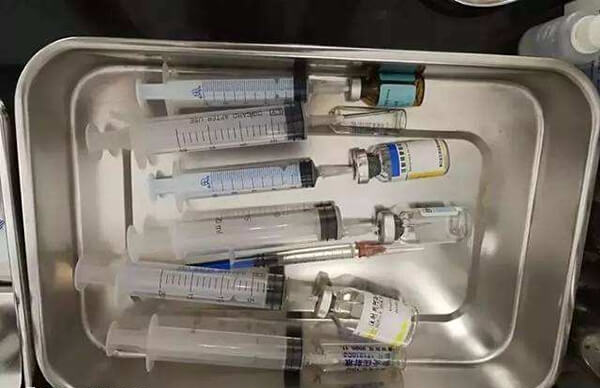 冲洗宫腔可改善内膜环境