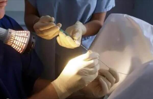 取卵手术会有疼痛感