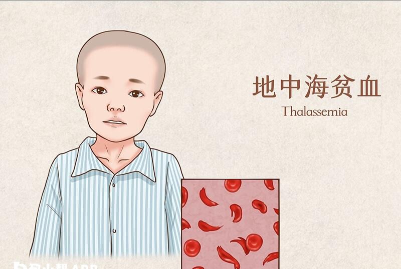 地贫是一种常染色体隐性遗传病