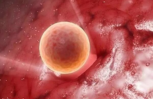 冻囊胚移植后会先在子宫腔内游走